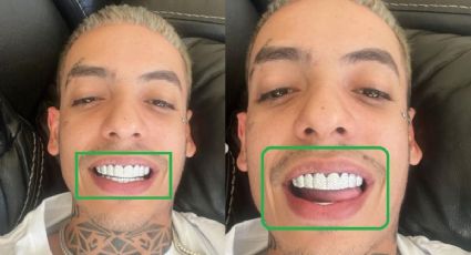 ¿Cuánto cuesta ponerse diamantes en los dientes? El lujoso detalle que se hizo Natanael Cano