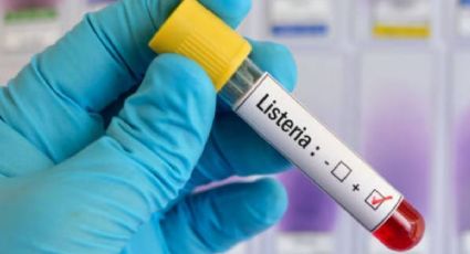 Brote de LISTERIA causa alerta en Estados Unidos; qué es, cómo se contagia y síntomas