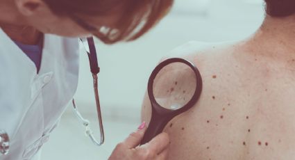 Esto es lo que debes saber sobre la NUEVA vacuna contra el cáncer de piel