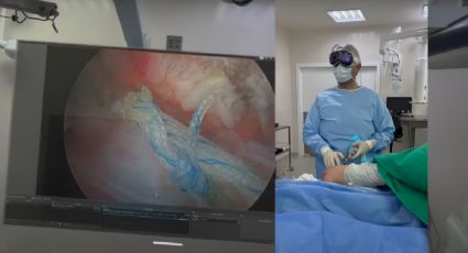 Cirujano comparte un video de la cirugía que realizó con sus Apple Visión Pro